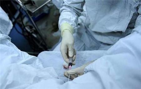 取卵后肚子变大，原因、护理与恢复