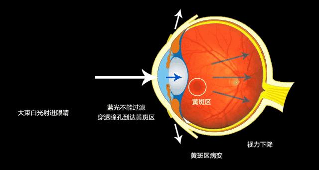 防蓝光眼镜检验真假的方法与注意事项