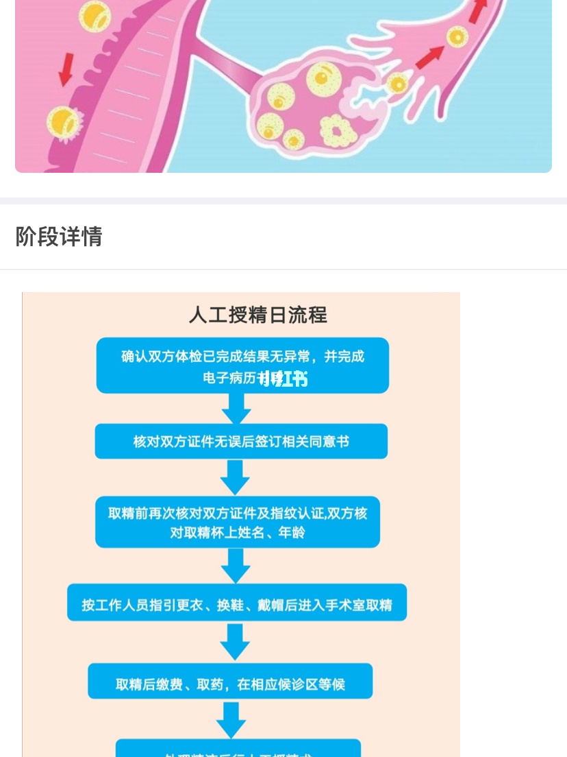 人工授精取卵费用详解