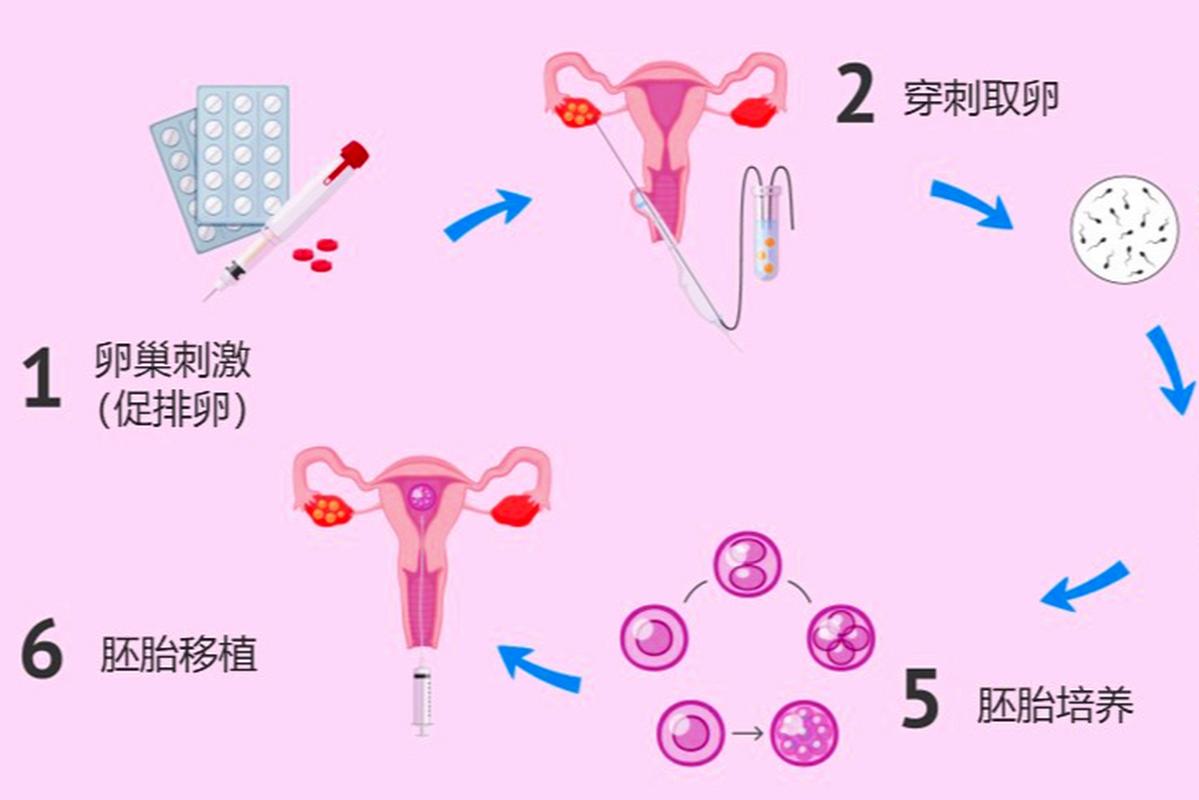 取卵后几天可以移植，时间与过程的详解