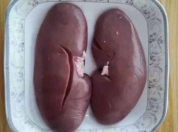 取卵腹水严重会没命吗