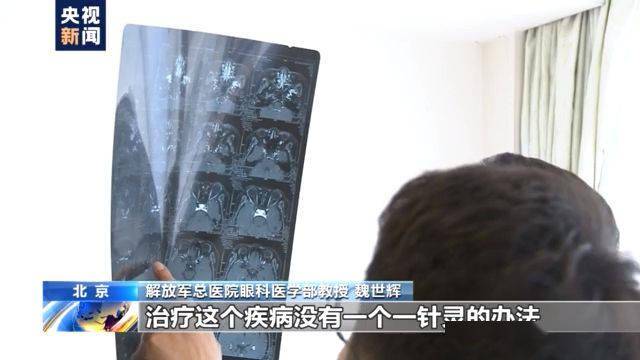 揭秘配镜真相，如何辨别真假镜片