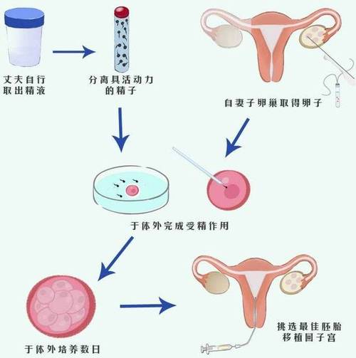 探究取卵前夜针的目的，辅助生殖技术中的关键环节